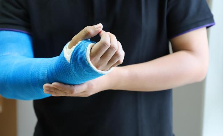 How Broken Bones Are Healed