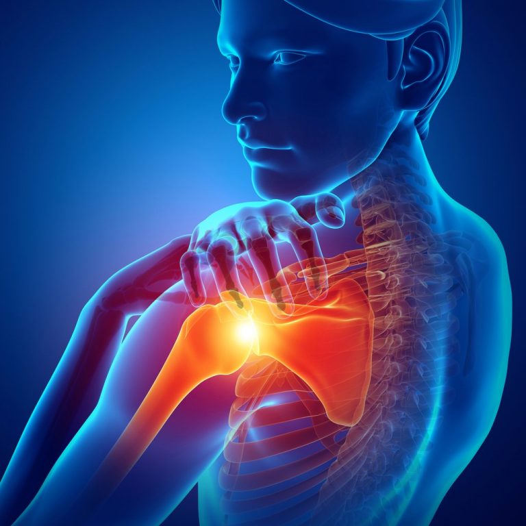 Podcast on Recovery from Shoulder Tendonitis