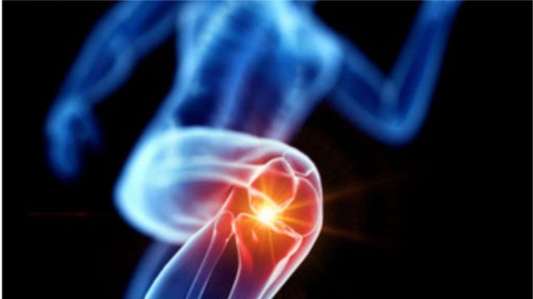 The difference between ACL and MCL injuries