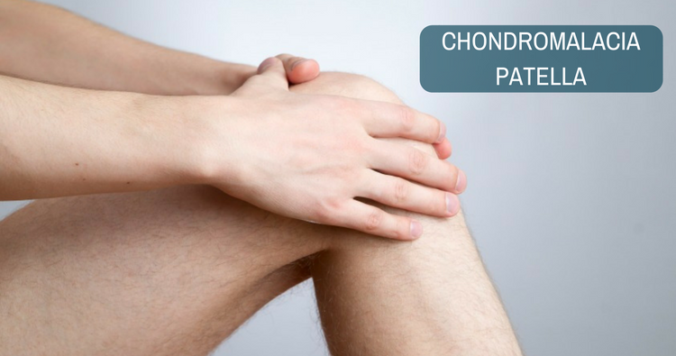 Chondromalacia Patellae Symptoms and Treatment