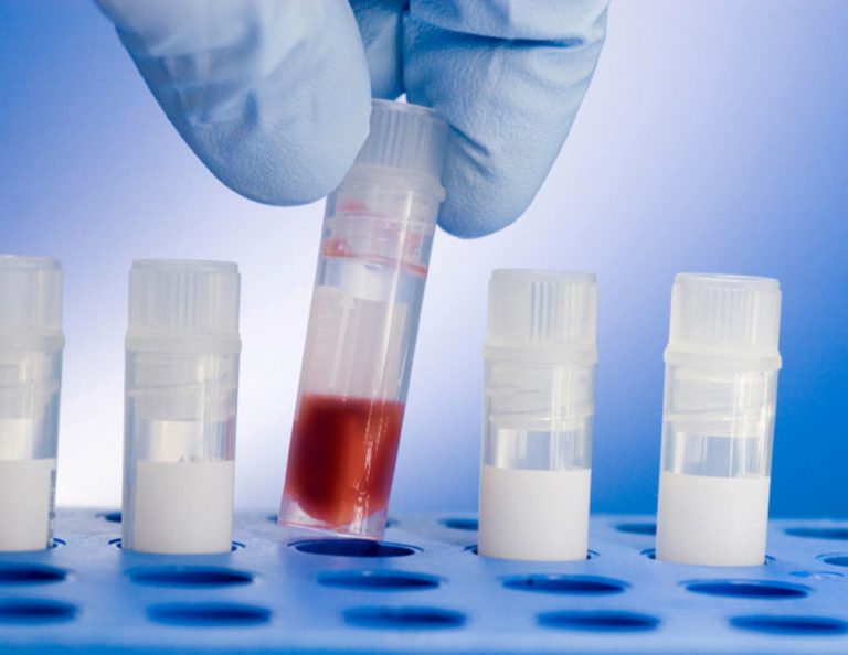 Advancements in Tissue Banking Technologies and Distribution