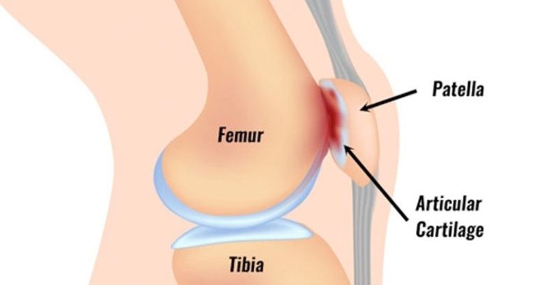 Ep 10: Knee Instability with guest Dr. Adam Yanke