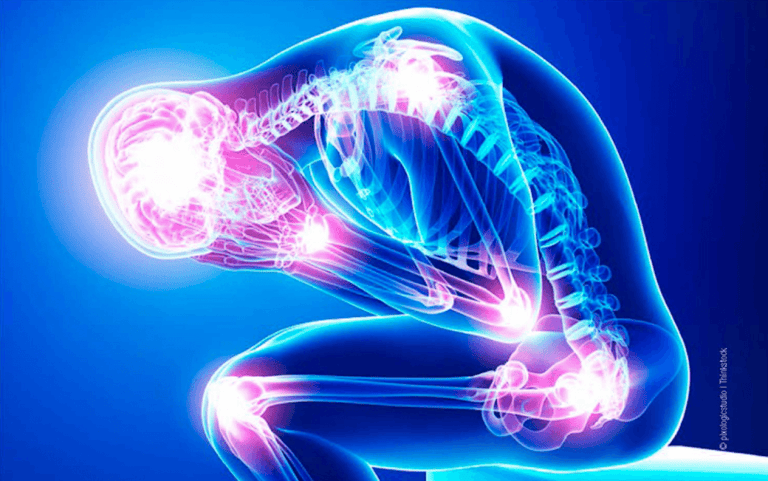 Inflammation: What is It and How to Fight It