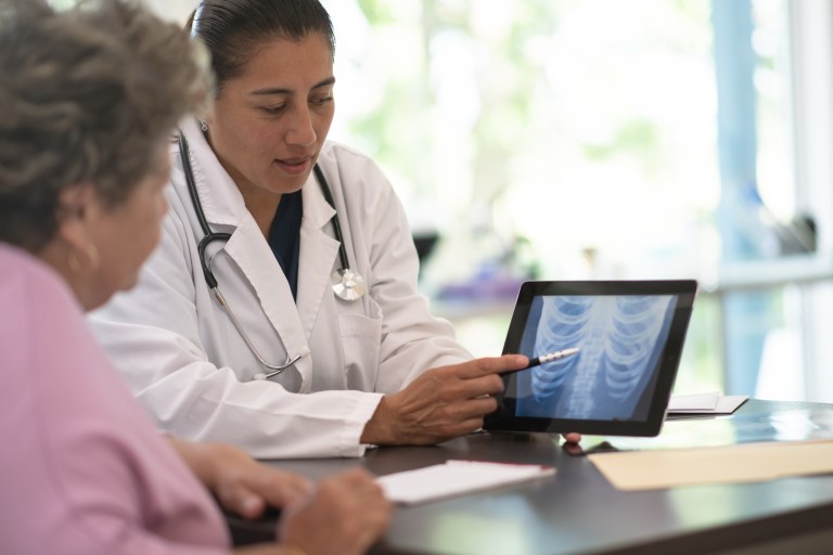 Four Common Symptoms of Osteoporosis and How It’s Treated