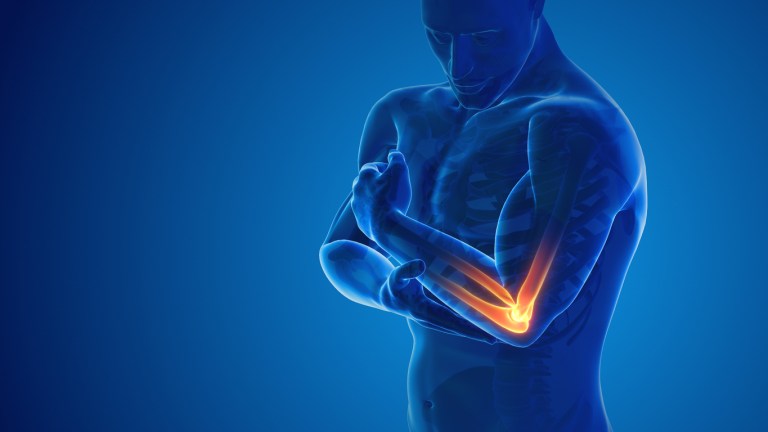 ‘Explosion’ of Tommy John surgery, elbow injuries in young athletes