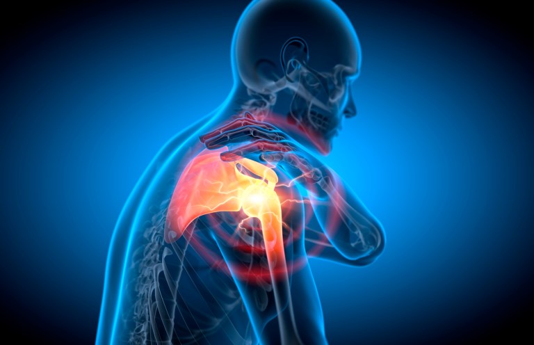 Minimally Invasive Shoulder Joint Replacement: Animation Video