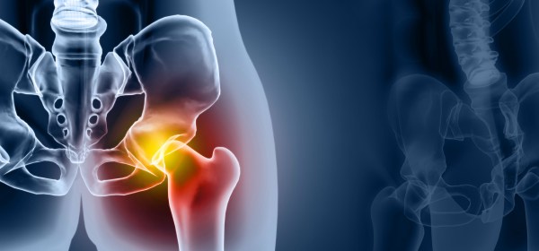 Understanding Hip Osteoarthritis: Causes, Symptoms, and Management