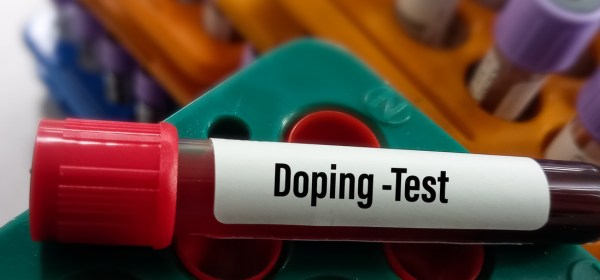 Challenges in Anti-Doping: Innovations and Future of Drug Testing in Sports