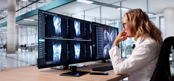 The Role of MRI in Athlete Recovery and Injury Healing