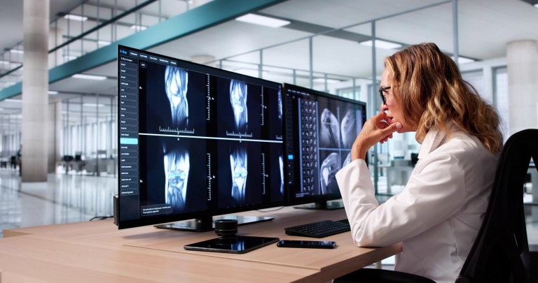 The Role of MRI in Athlete Recovery and Injury Healing